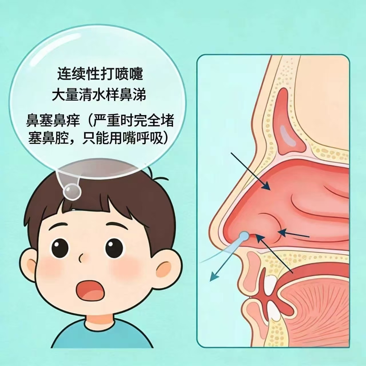 连续喷嚏.jpg